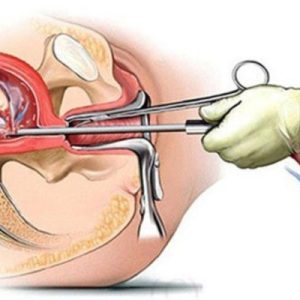 Đình Chỉ Thai Kỳ An Toàn Tại Nhà Có Được Không? Phân Tích Về Mặt Y Khoa